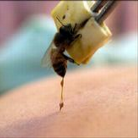 http://i1-news.softpedia-static.com/images/news2/Apitherapy-The-Bee-Venom-Therapy-3.bmp