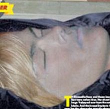 Celebrity Autopsy Pictures on Fake Photos Of Anna Nicole Smith S Corpse Were Real