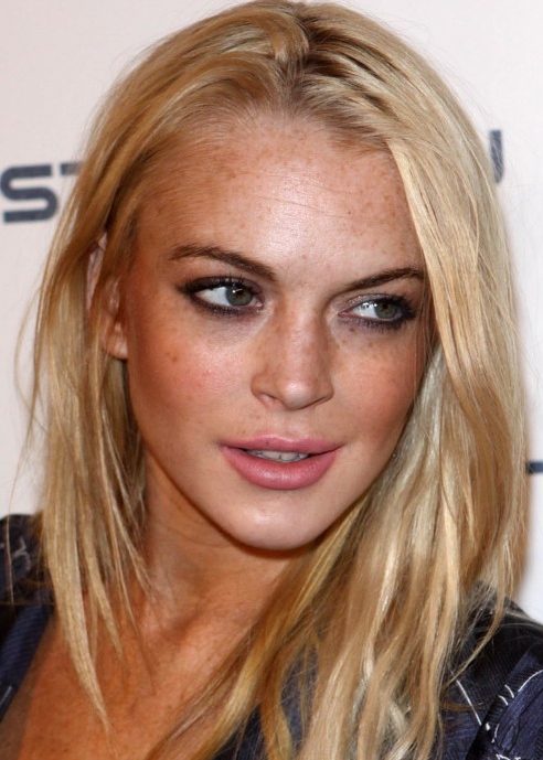 lindsay lohan plastic surgery.  added at least ten years to Lindsay Lohan's face, plastic surgeon says