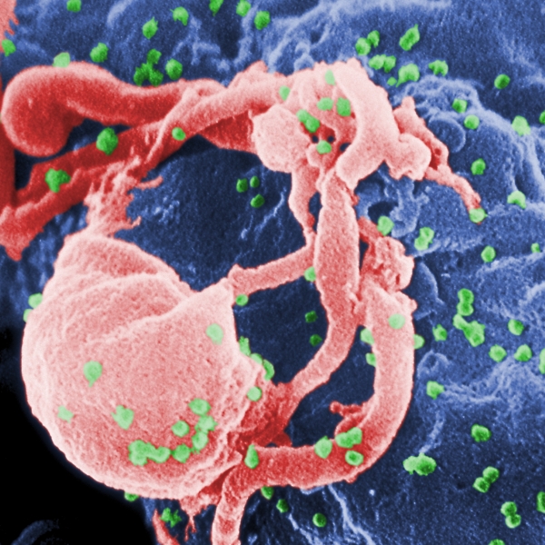 Molecule Boosts AIDS Immune System Response