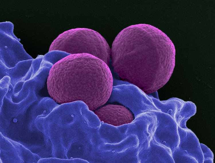 mrsa bacteria picture #10