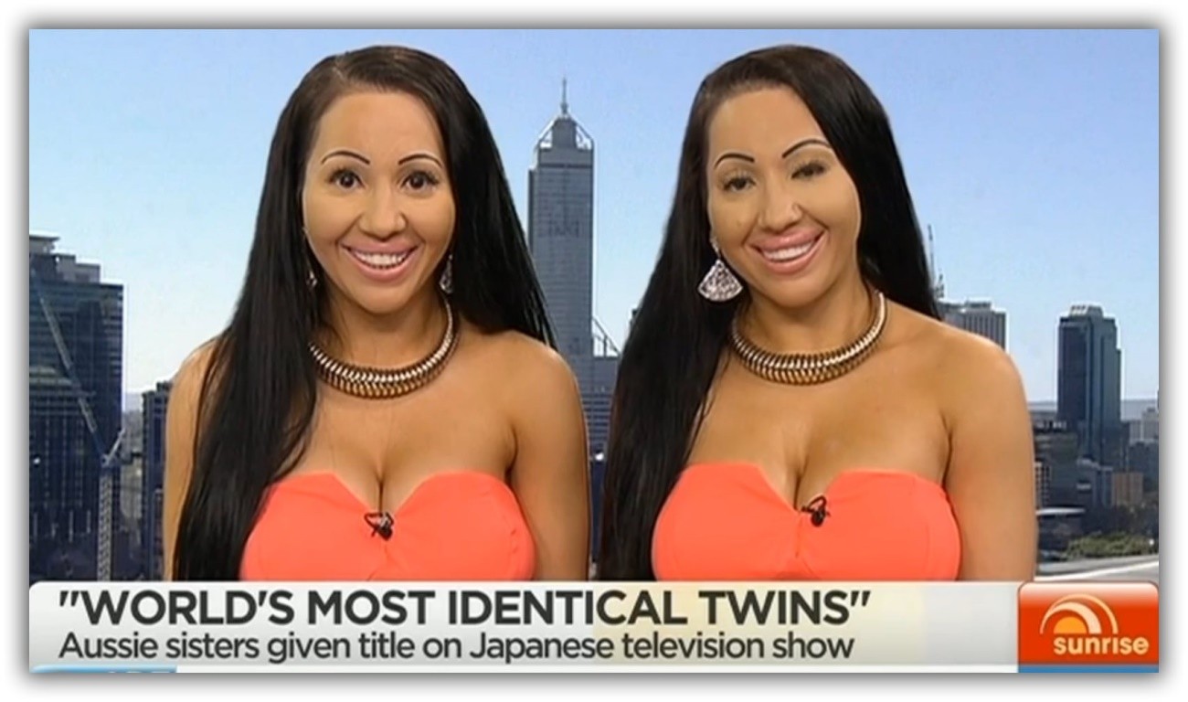 Twins Who Spent 250 000 On Plastic Surgery To Look The