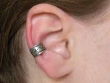 tinnitus bilateral maxillary mucous